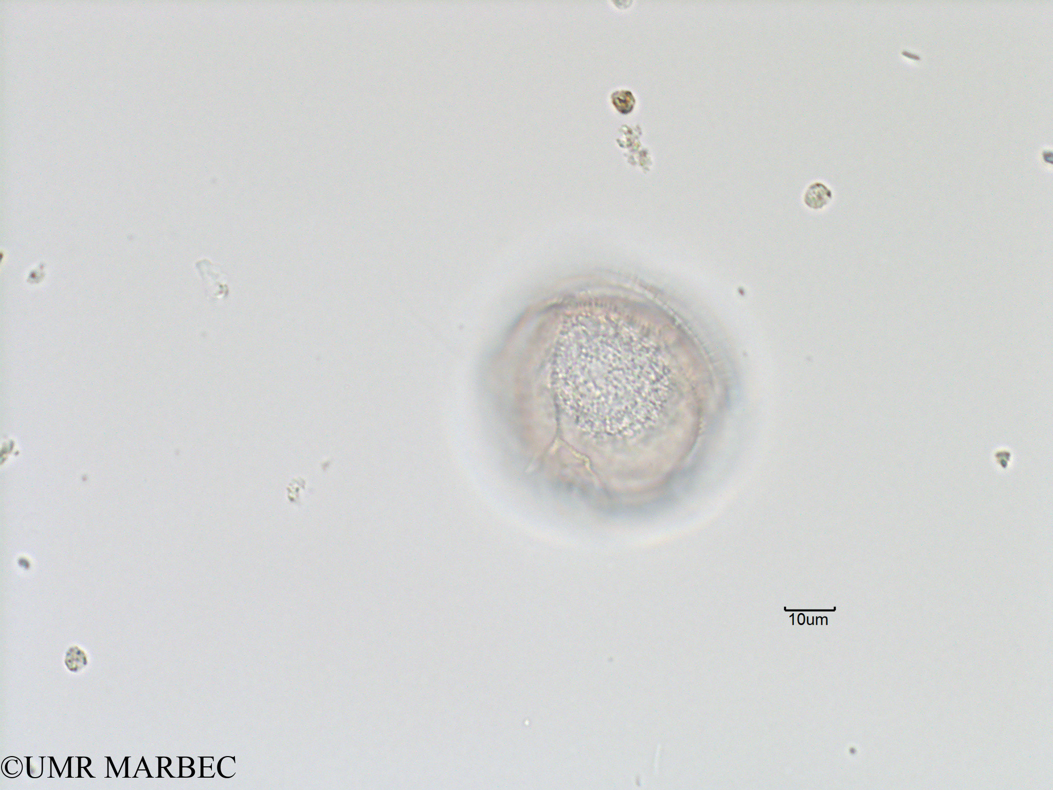 phyto/Bizerte/bizerte_bay/RISCO November 2015/Protoperidinium sp46 (Baie_T5-C3-dino avzc suture-2).tif(copy).jpg